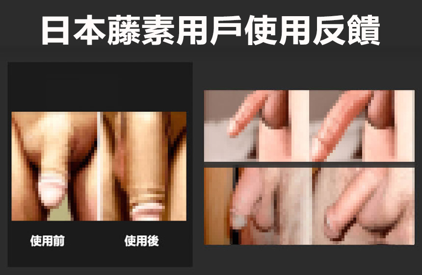 日本藤素真實效果反饋